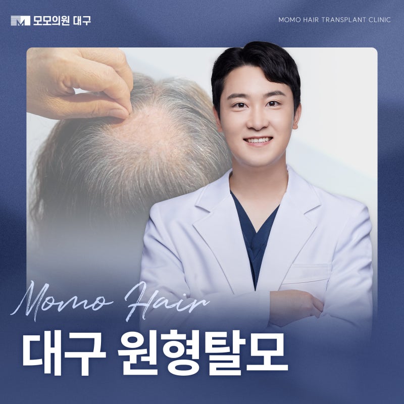 대구 원형탈모 진단이 필요한 신호와 단계별 치료 방법