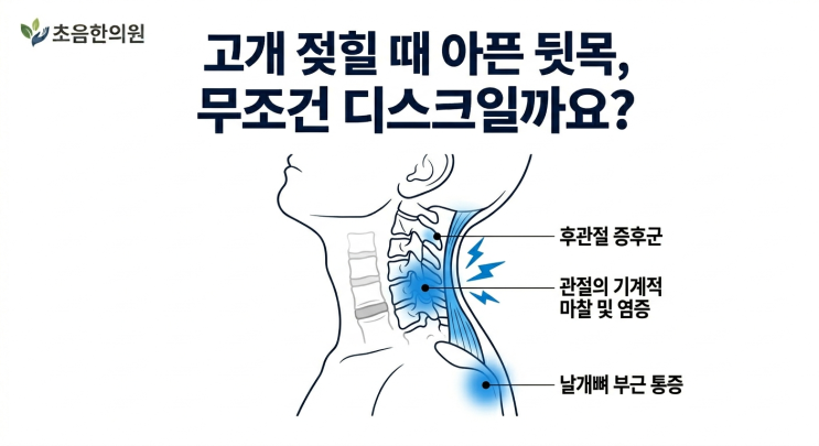  뒷목 뻐근함 고개젖힐때 날개뼈 통증 목디스크일까요? 후관절 증후군