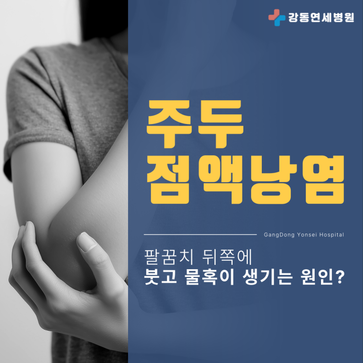  천호 풍납동정형외과 팔꿈치 물혹 원인 주두점액낭염 증상, 치료 없이 놔둬도 되나요?