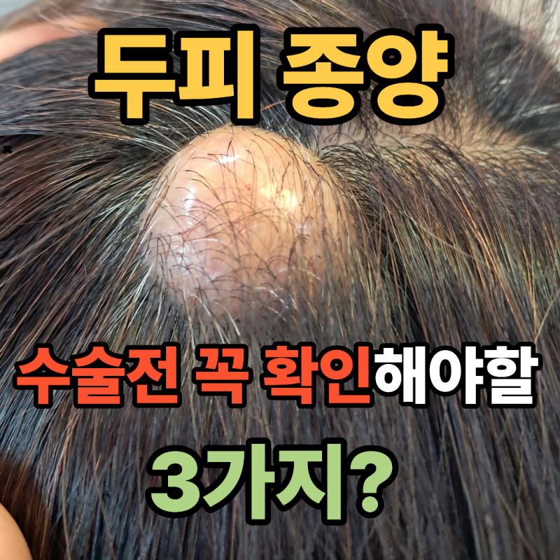 두피 종양 수술 전 꼭 확인해야할 사항?(천보성 외과)