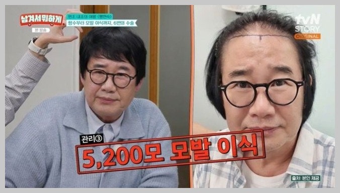팽현숙, 최양락 동안 비법 직접 폭로 "입꼬리 수술→5,200모 심었다"