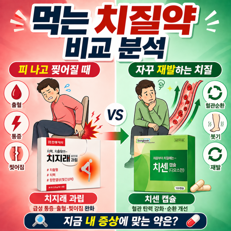 먹는 치질약 비교 치지래 vs 치센 차이 총정리 (증상별 선택 가이드) - 종로백제약국(원조)