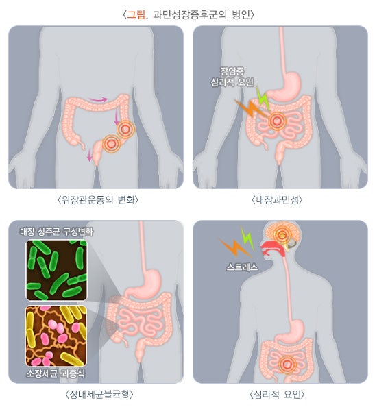 헬리코박터균원인 영양제 추천 제균약 치료 이것만 알면 끝