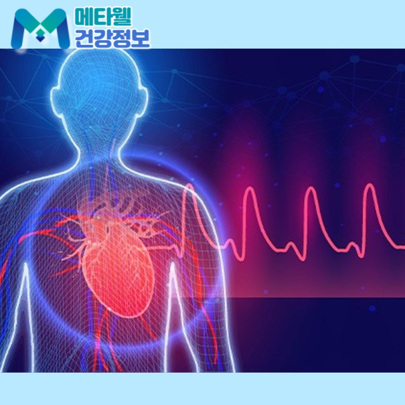 급성 심근경색 전조증상이 소화불량? 원인, 검사, 치료 방법