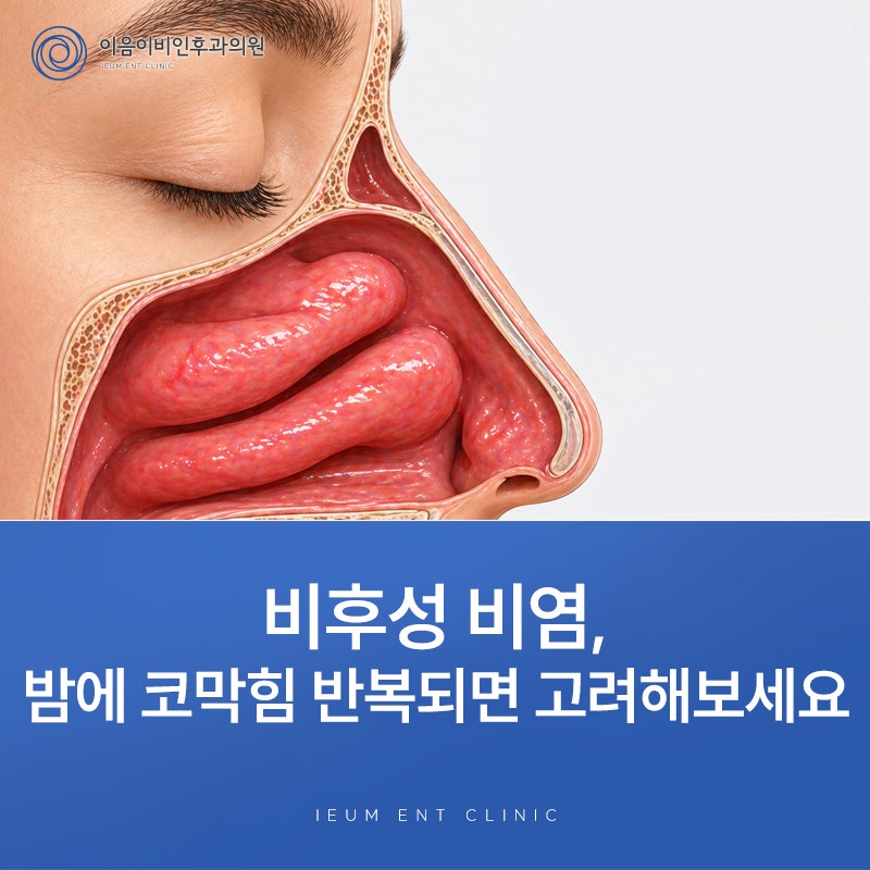 비후성 비염, 코가 계속 막혀 있는 상태라면