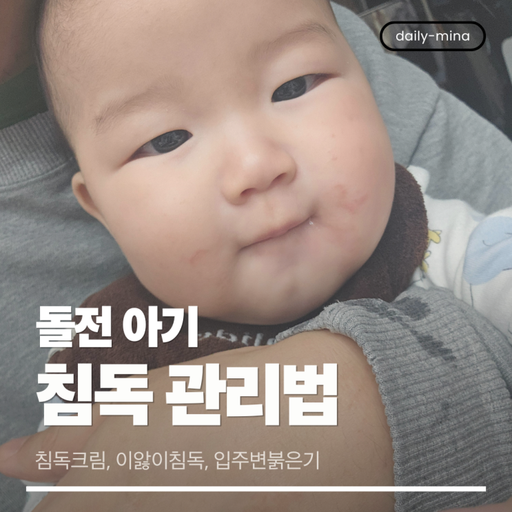  돌전 아기 침독 관리법(침독크림,이앓이침독,입주변붉은기)