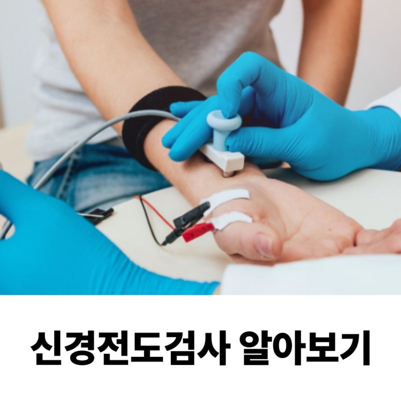 [재활의학과] 신경전도검사/근전도 검사가 꼭 필요한 이유.