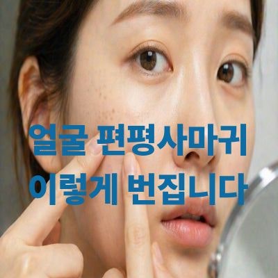 [광고]얼굴 편평사마귀 계속 늘어나는 이유(생기는 이유, 번지는 원인, 없애는 방법)