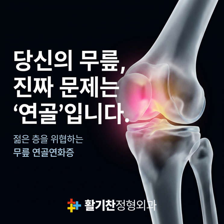  은평구무릎통증, 연골연화증 극복하는 일상 속 생활 수칙