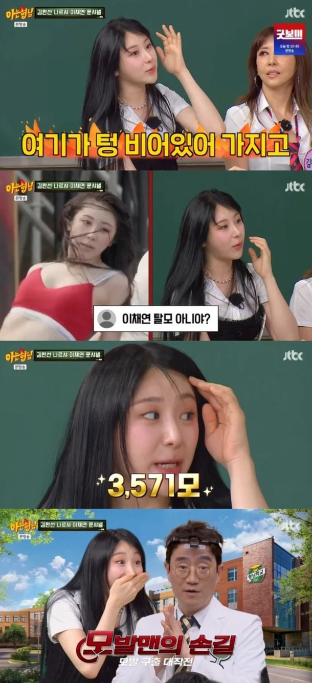 이채연 "워터밤 흑채 씻겨 탈모 들켜, 바로 모발이식"