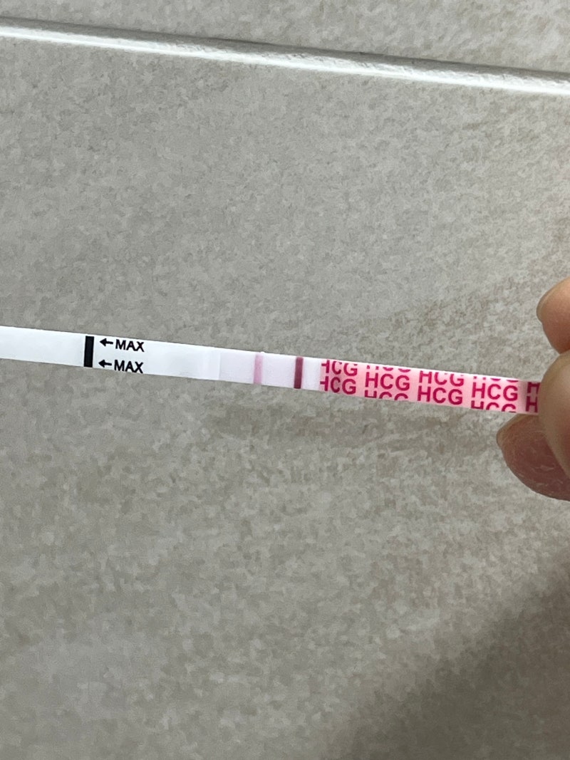 화학적 유산 후 자궁외 임신 의심,피검사 수치 110에서 1480 재상승 및 병원비 차이 비교