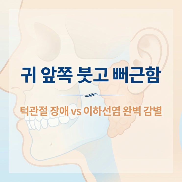  귀 앞쪽 턱 붓기 통증, 턱관절 장애일까 이하선염 임파선염일까? 감별 증상과 시호청간탕 한의원 치료
