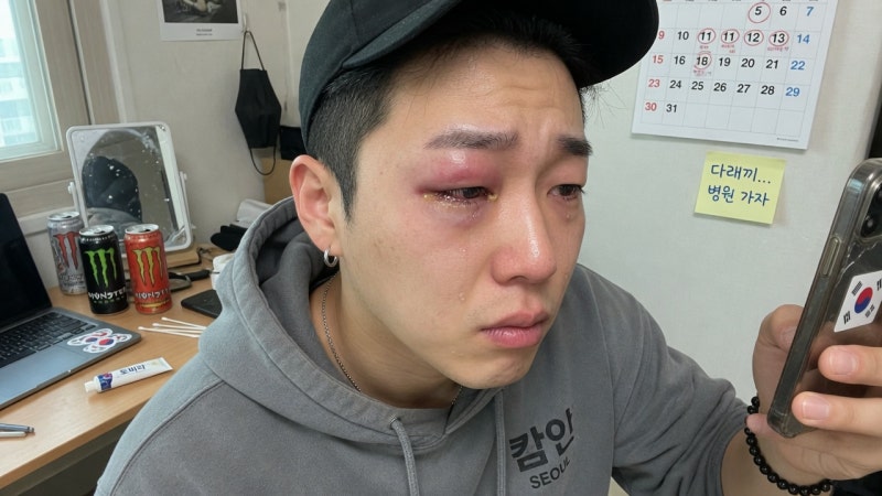 눈다래끼 완벽 가이드: 증상부터 가라앉는 법까지