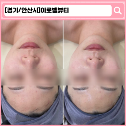 '아로벨뷰티' 안산 선부동 피부관리
