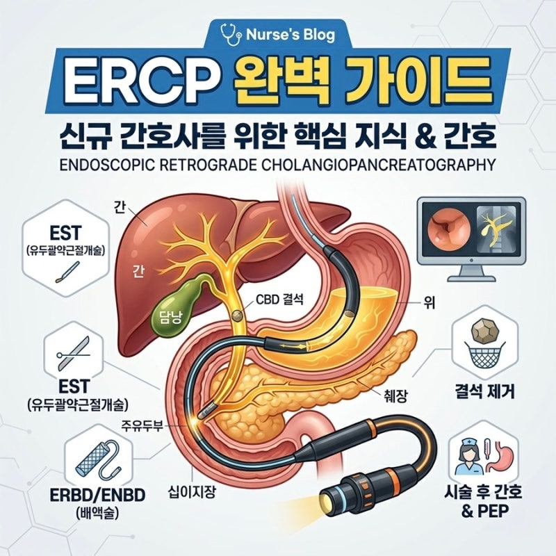 ERCP 시술 전후 간호 프로토콜 총정리