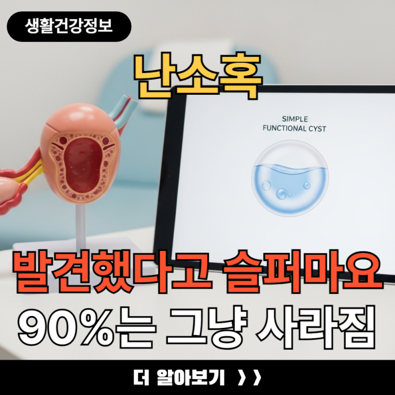 난소혹 발견했다고 울지 마세요 90%는 저절로 사라집니다