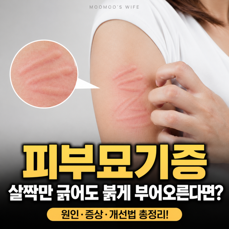 피부묘기증 원인 및 증상, 살짝만 긁어도 붉게 부어오르는 피부질환 개선법
