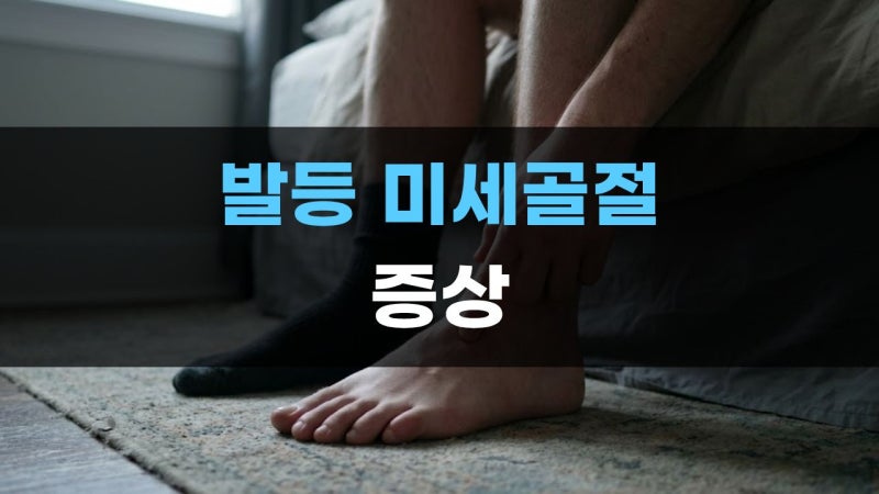 발등 미세골절 증상 통증 붓기 멍, 진단 엑스레이 초음파 CT MRI 어떻게 할까?