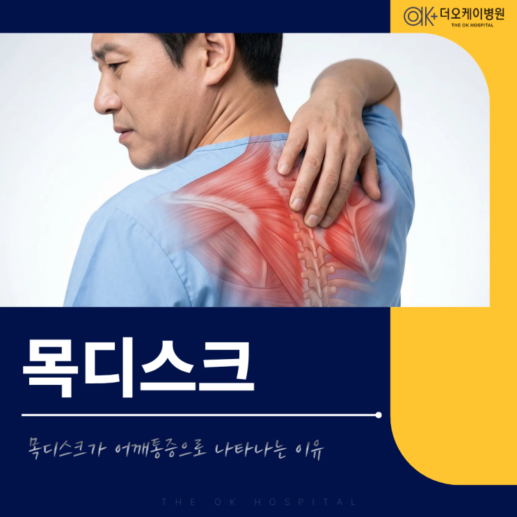  춘천정형외과, 목디스크가 어깨통증으로 나타나는 이유