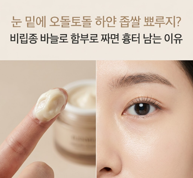 눈 밑에 오돌토돌 하얀 좁쌀 뾰루지? 비립종 바늘로 함부로 짜면 흉터 남는 이유