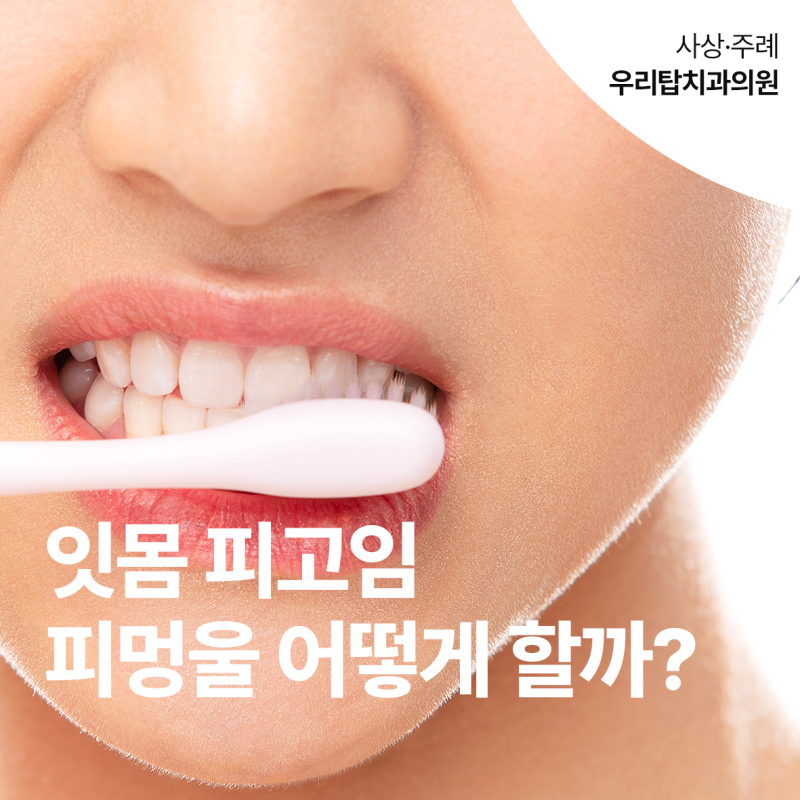 입안 잇몸 피고임 피멍울 스스로 터트리기?