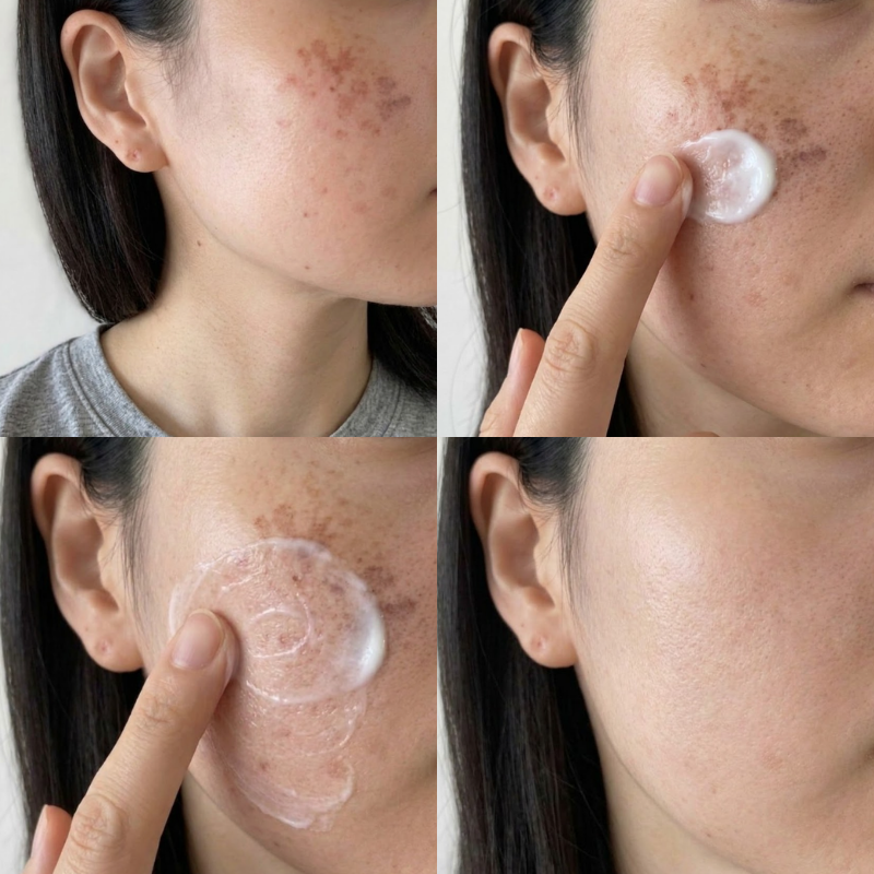 전지현 멜라토닝크림 트라넥삼산 사용법 부작용 가격 후기