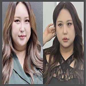 30kg 뺀 풍자, "코골이 사라졌다" 고백… 다이어트가 부른 놀라운 변화