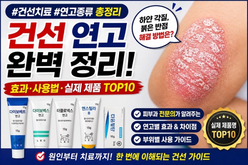건선 피부과 약 종류 총정리