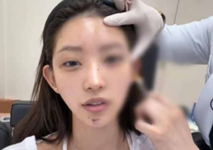   최준희 결혼 앞두고 시술까지? 예비 신부의 현실 일상 공개
