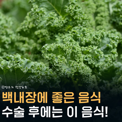 백내장에 좋은 음식! 수술 후에는 어떤 것이 좋을까?