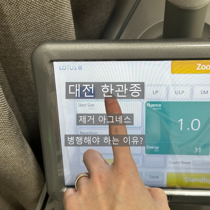 대전 한관종 제거 아그네스 병행해야 하는 이유?