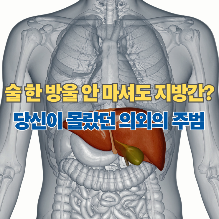  술도 안 마시는데 지방간? 간에 좋은 음식 찾기 전 꼭 알아야 할 의외의 원인