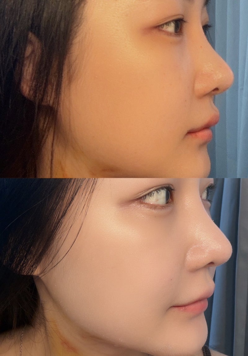 썬크림추천 광채피부 수아이레글로우필터선크림 톤업선크림 후기