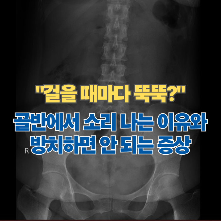  "걸을 때마다 뚝뚝?" 골반에서 소리 나는 이유와 방치하면 안 되는 증상