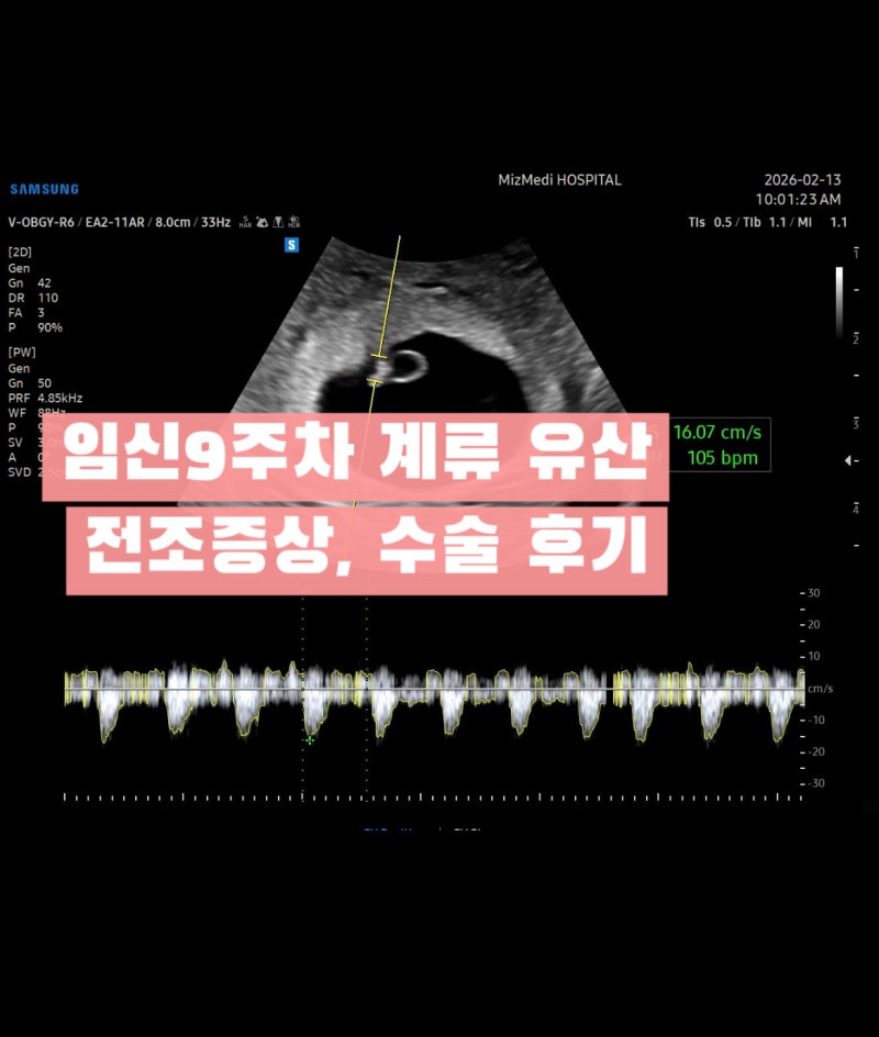 임신 9주차 심장 멈춤 계류유산 전조 증상, 소파술 경험담 (수술 과정, 유산휴가)