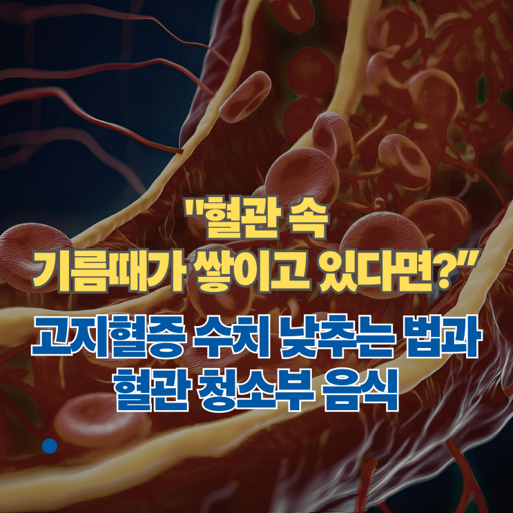  "혈관 속 기름때가 쌓이고 있다면?" 고지혈증 수치 낮추는 법과 혈관 청소부 음식
