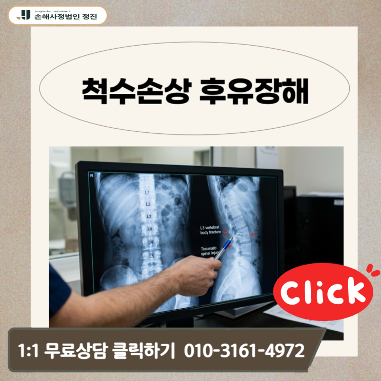  척수손상 후유장해 보험금, 마비인데도 거절되는 이유 (손해사정사 실무 기준)