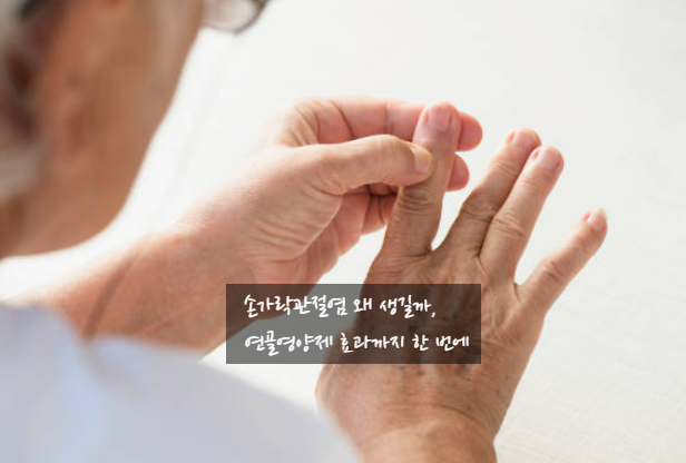 손가락관절염 왜 생길까, 연골영양제 효과까지 한 번에
