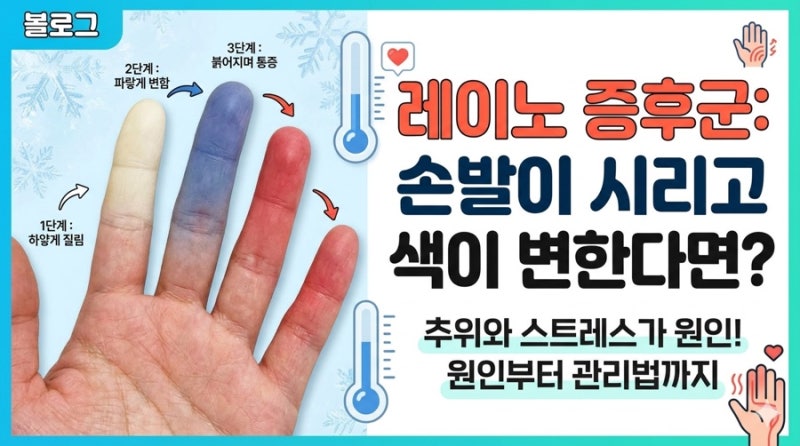 레이노 증후군 이해하기