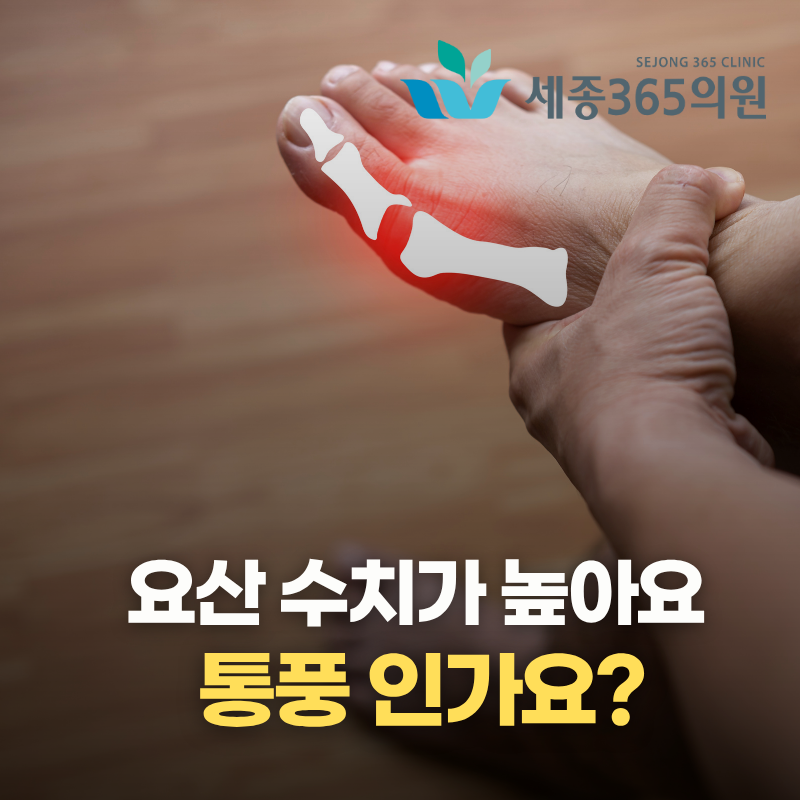 세종시 통풍 치료, 요산 수치 검사로 시작
