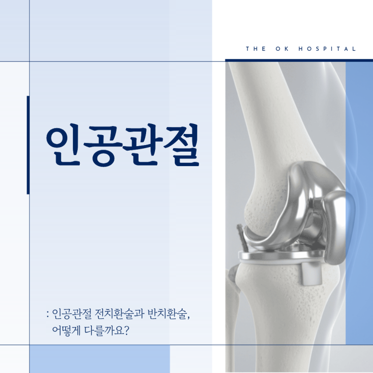  화천정형외과, 무릎 인공관절 전치환술과 반치환술, 어떻게 다를까?