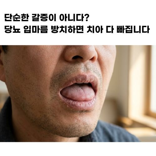 자고 나면 입안이 쩍쩍? 당뇨 입마름(구강 건조증) 해결법과 방치하면 위험한 이유 [구강 건....