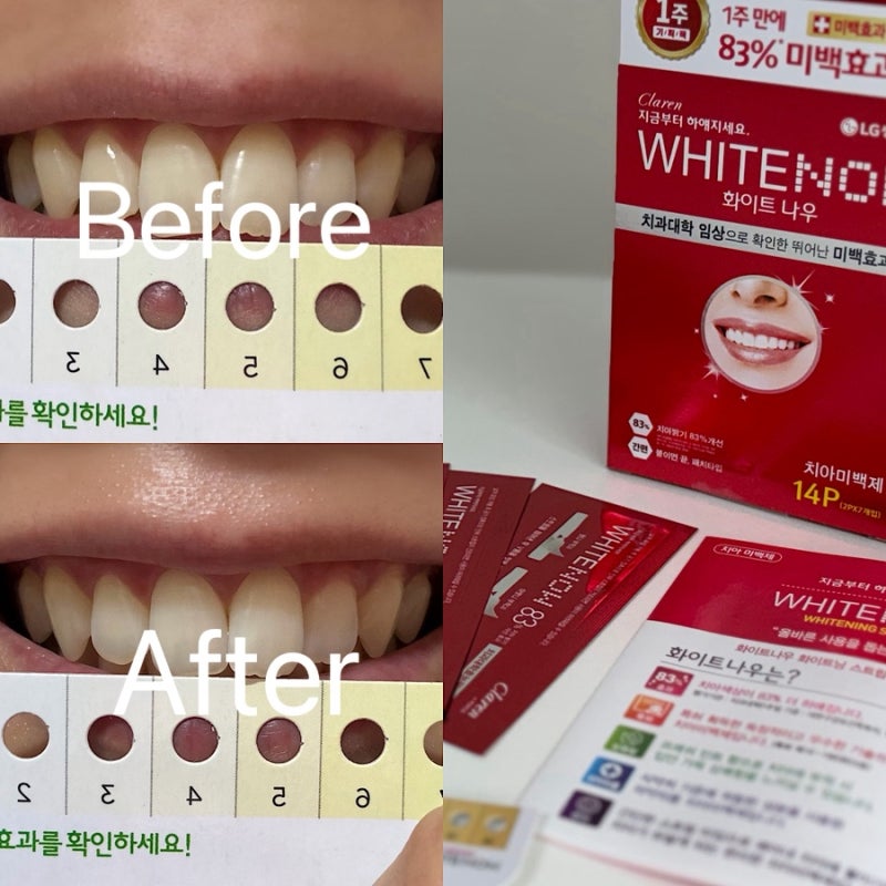 페리오 화이트나우 내돈내산 후기