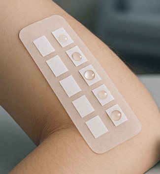 알레르기검사 종류, 비용, 실비 청구, 병원은 어디로?