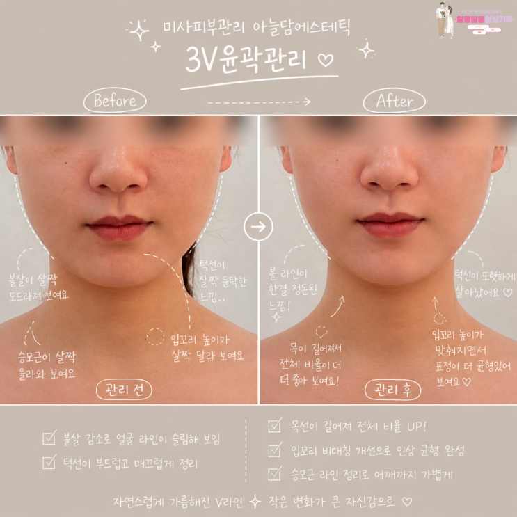  미사피부관리 '아늘담에스테틱' 3V윤곽관리 솔직 후기