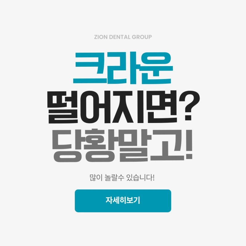 | 크라운 #6 | 크라운 떨어지면 당황하지 마세요, 재부착 가능 여부와 대처법 정리