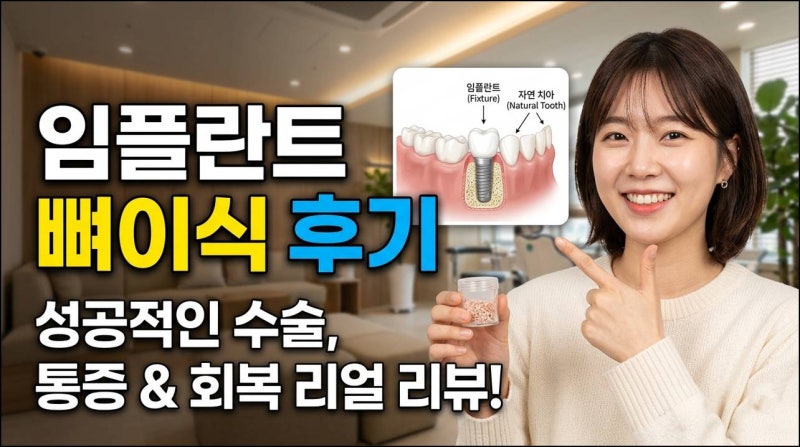 임플란트 뼈이식 통증 솔직 후기, 마취 풀리면 얼마나 아플까?