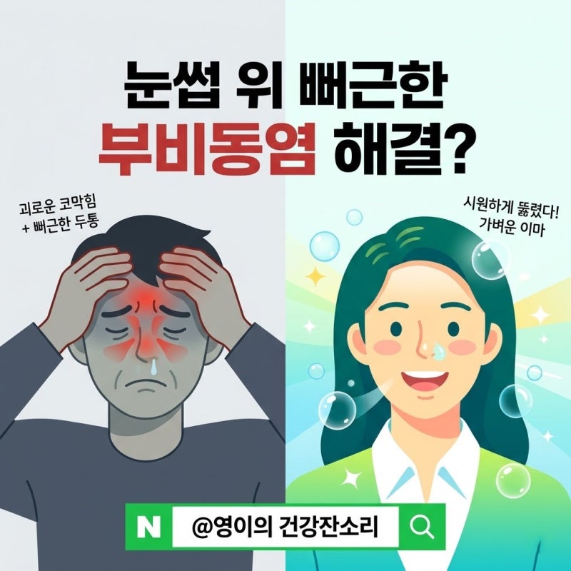 눈썹 위 이마 뻐근한 두통 부비동염 축농증 코막힘 해결법