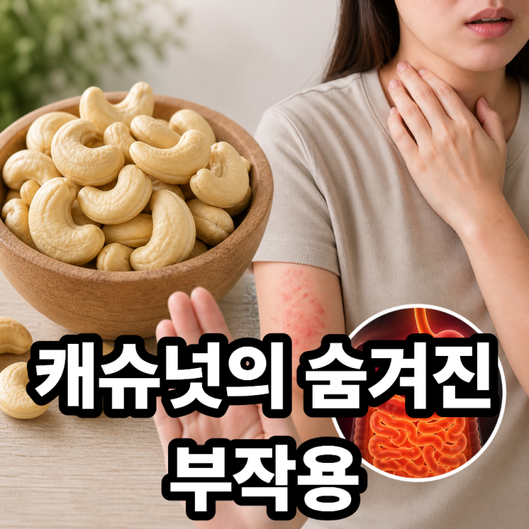  캐슈넛 부작용 꼭 알아야 하는 5가지 ️ 건강하게 먹는 법