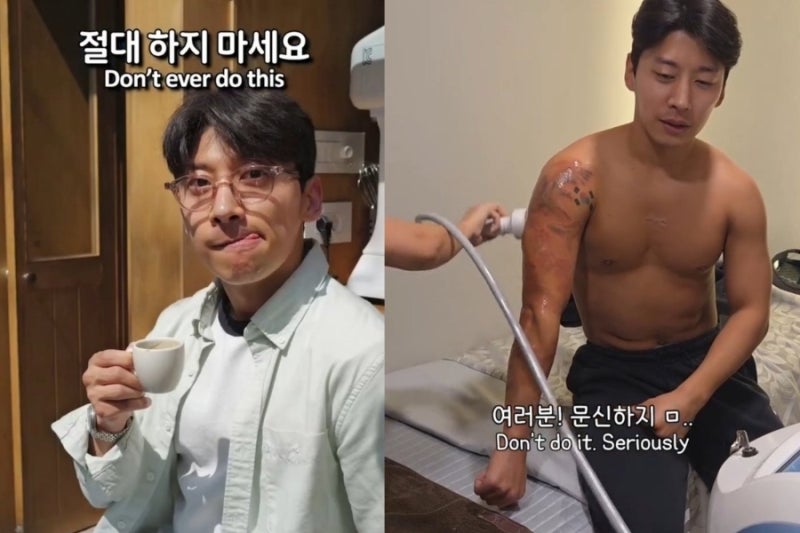 곽윤기 "3년째 문신 지우는 중, 살 타는 냄새 난다"…피부과 전문의가 말하는 문신 제거 완전 ....